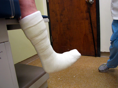 Botte de décharge